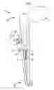 Fig. 02 - Instruments and methods for tensioning a spinal tether