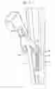 Fig. 06 - Instruments and methods for tensioning a spinal tether
