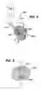 Fig. 09 - EXPANDABLE FILLERS FOR BONE CEMENT