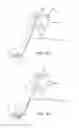 Fig. 05 - Spinal Diagnostic Methods and Apparatus