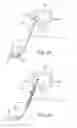 Fig. 07 - Spinal Diagnostic Methods and Apparatus