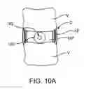 Fig. 16 - Spinal Diagnostic Methods and Apparatus