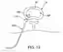 Fig. 20 - Spinal Diagnostic Methods and Apparatus