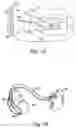 Fig. 02 - Method for discriminating between ventricular and supraventricular arrhythmias