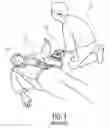 Fig. 02 - Automated external defibrillator (AED) with context-sensitive help