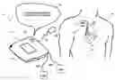 Fig. 01 - Defibrillator with implantable medical device detection