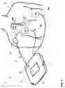 Fig. 10 - Defibrillator with implantable medical device detection