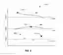 Fig. 05 - Method, apparatus, and system to optimize cardiac preload based on measured pulmonary artery pressure