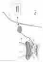 Fig. 03 - Method and Apparatus for Treating Incontinence