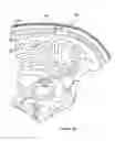Fig. 29 - Systems and Methods for Treating Neurological Disorders by Light Stimulation