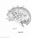 Fig. 33 - Systems and Methods for Treating Neurological Disorders by Light Stimulation