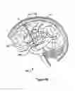 Fig. 34 - Systems and Methods for Treating Neurological Disorders by Light Stimulation