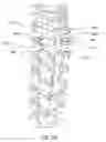 Fig. 04 - Methods for treating the thoracic region of a patient's body