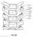 Fig. 05 - Methods for treating the thoracic region of a patient's body