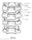 Fig. 06 - Methods for treating the thoracic region of a patient's body