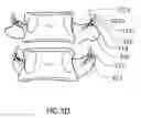 Fig. 07 - Methods for treating the thoracic region of a patient's body