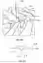 Fig. 15 - Methods for treating the thoracic region of a patient's body