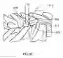 Fig. 17 - Methods for treating the thoracic region of a patient's body