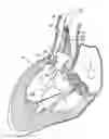 Application 20090054969, fig. 01