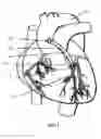 Fig. 02 - Methods and Devices for Coupling a Device Insertable within a Mammalian Body