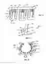 Fig. 13 - Methods and Devices for Coupling a Device Insertable within a Mammalian Body