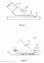 Fig. 24 - Methods and Devices for Coupling a Device Insertable within a Mammalian Body