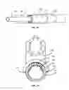Fig. 26 - Methods and Devices for Coupling a Device Insertable within a Mammalian Body
