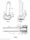 Fig. 31 - Methods and Devices for Coupling a Device Insertable within a Mammalian Body