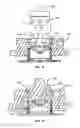 Fig. 32 - Methods and Devices for Coupling a Device Insertable within a Mammalian Body