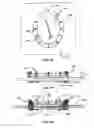 Fig. 33 - Methods and Devices for Coupling a Device Insertable within a Mammalian Body