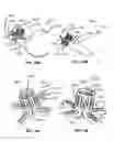 Fig. 47 - Methods and Devices for Coupling a Device Insertable within a Mammalian Body