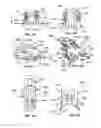 Fig. 49 - Methods and Devices for Coupling a Device Insertable within a Mammalian Body
