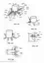 Fig. 55 - Methods and Devices for Coupling a Device Insertable within a Mammalian Body