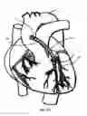 Fig. 61 - Methods and Devices for Coupling a Device Insertable within a Mammalian Body
