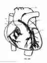 Fig. 62 - Methods and Devices for Coupling a Device Insertable within a Mammalian Body