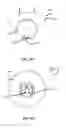 Fig. 70 - Methods and Devices for Coupling a Device Insertable within a Mammalian Body