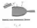 Fig. 12 - DEPLOYMENT DEVICE FOR CARDIAC SURGERY
