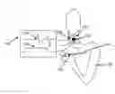 Fig. 01 - Device for volitional swallowing with a substitute sensory system