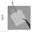 Fig. 02 - Method For Use Of A Double-Structured Tissue Implant For Treatment Of Tissue Defects