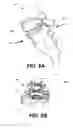 Fig. 09 - SPINAL FUSION ASSEMBLY