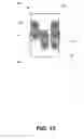 Fig. 14 - SPINAL FUSION ASSEMBLY