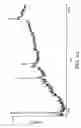 Fig. 09 - Proteomic analysis of biological fluids
