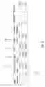 Fig. 08 - Decrypting load balancing array system