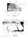 Fig. 02 - Apparel Having a Replaceable Outer Layer