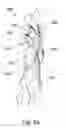 Fig. 08 - Apparel Having a Replaceable Outer Layer