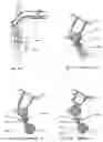 Fig. 09 - Upright vacuum cleaner
