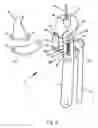 Fig. 10 - HAND OPERATED GRIPPING TOOL