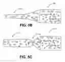 Fig. 07 - Methods and devices for occluding an ovarian pathway