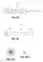Fig. 08 - Methods and devices for occluding an ovarian pathway