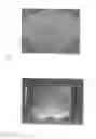 Fig. 07 - Ultrasonically Detectable Intrauterine System and a Method for Enhancing Ultrasound Detection